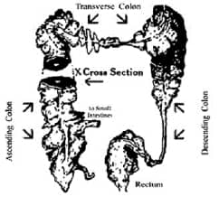 ColonToxico