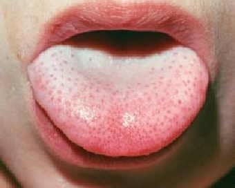 Lengua2 (1)