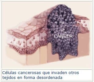 celulasCancer (1)
